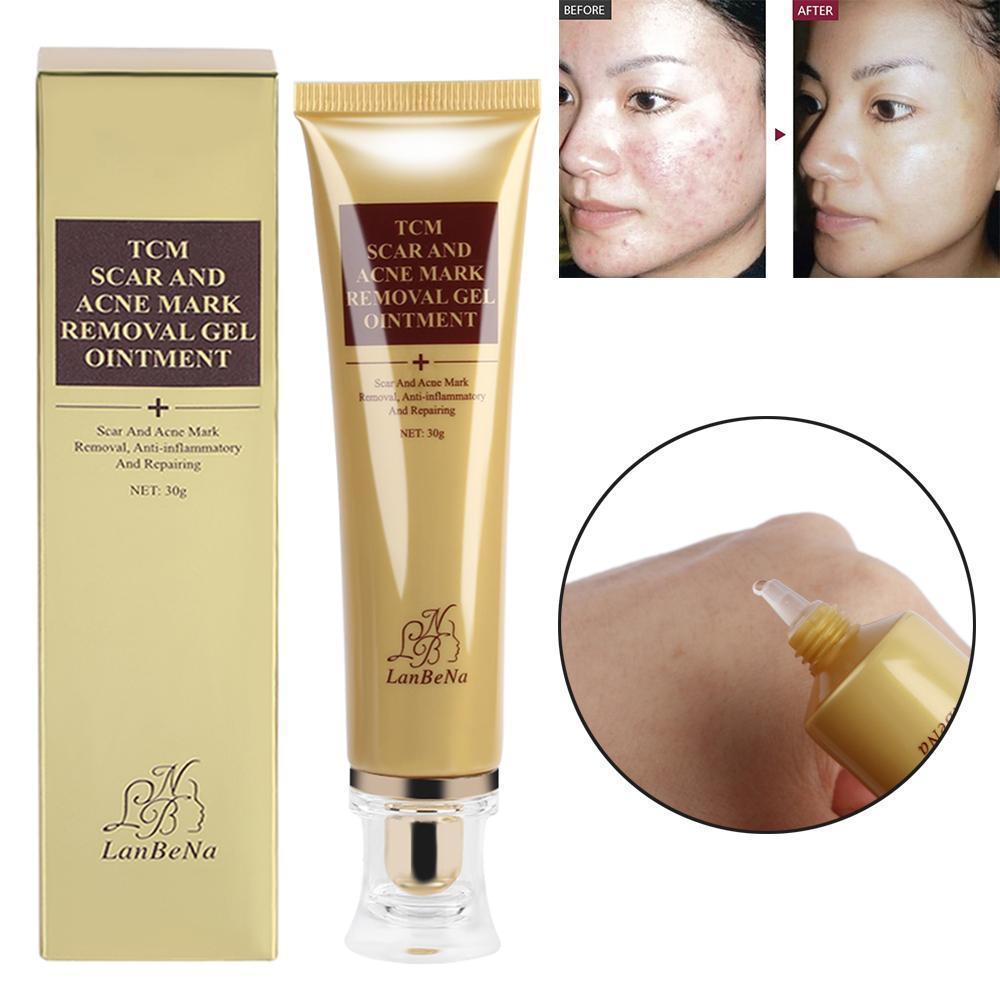 Acne Scar Remover Cream