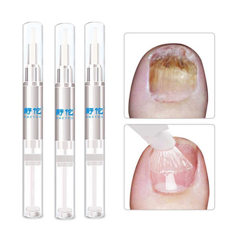 Herbal Nail Fungus Treatment Pen