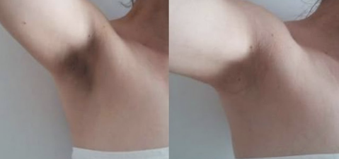 Pro-Beauty Whitening Cream